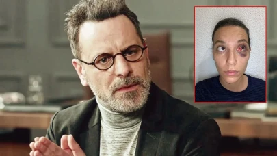 Ozan Güven, Kadına Şiddet İddialarını İlk Kez Yanıtladı